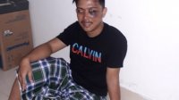 Dosen UMI, AM terlihat penuh luka dan memar usai menjadi korban salah tangkap saat aksi unjuk rasa, Kamis 8 Oktober 2020. (Ist) Dosen UMI, AM terlihat penuh luka dan memar usai menjadi korban salah tangkap saat aksi unjuk rasa, Kamis 8 Oktober 2020. (Ist)