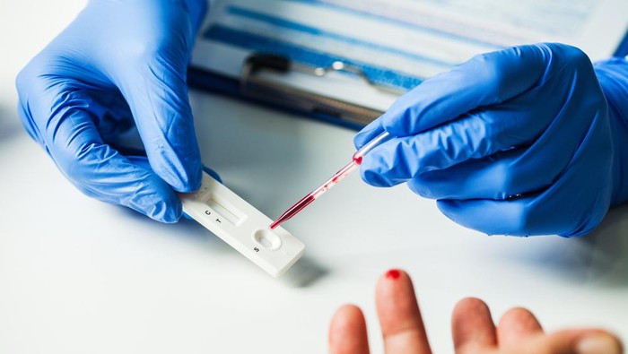 Pemkot Makassar mulai memberlakukan suket bebas Covid 19 bagi warga yang ingin keluar masuk Makassar. (Int)